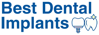 Best Dental Implant Center